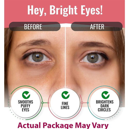 Lookatme Hydrogel Eye Patch Aloe Vera  1.1 Ounce 1