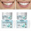 Baking Soda Tooth Intensive Remover Teeth Powder,tooth Powder, Enamel Safe 5