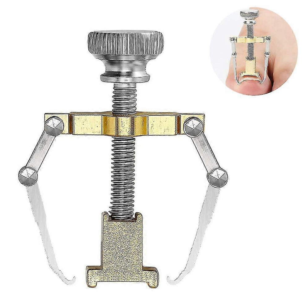 Gold (Gold) Ingrown Toenail Corrector Lifter Tool Pedicure Toenail Foot Nail Care,Eliminate Pain Remover Orthotic Appliance