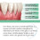 DentiZen Gum Regrowth Drops 1/2/3/5Pcs 3
