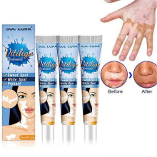 3x Vitiligo Skin Repair Cream,Vitiligo Treatment Cream, Dispose of White Spots on Skin and Improve Skin Pigmentation
