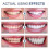 (3pcs) Sp-6 Probiotic Toothpaste,sp-6 Toothpaste 4