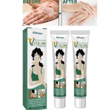 1-5pcs Vitiligo Skin Repair Cream,Vitiligo Treatment Cream, Dispose of White Spots on Skin and Improve Skin Pigmentation