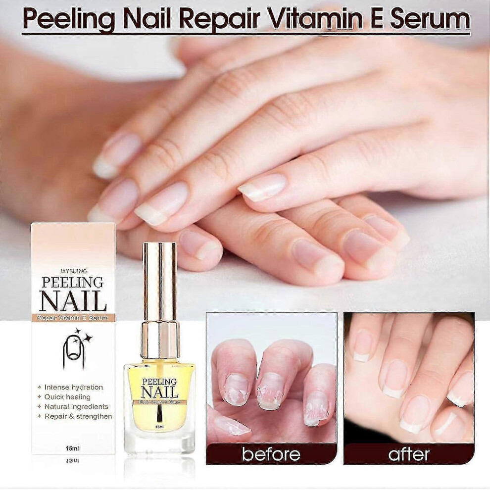 Vitamin E Serum for Nails and Cuticles, Nourishing Oil for Dry and Damaged Nails