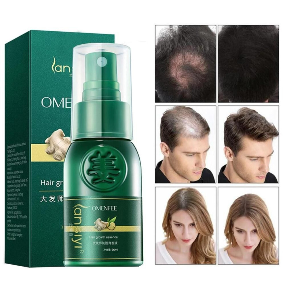 (30ml) Ginger Hair Growth Spray Serum Anti Hair Loss Products Fast Grow Prevent Hair Dry Frizzy Damaged Thinning Repair Care