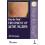 Step by Step Treatment of Acne Scars 1
