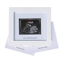 IHEIPYE Baby Sonogram Foto-Rahmen - 1. Ultraschallbild-Rahmen - Geschenkidee für werdende Eltern