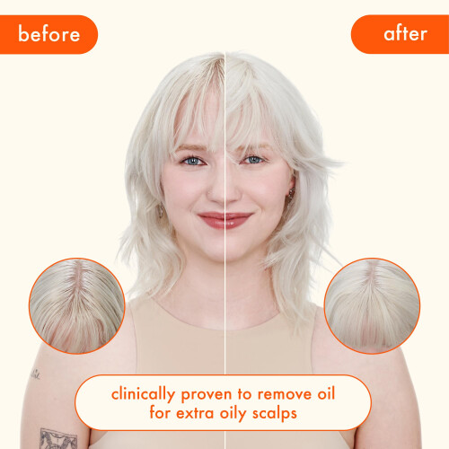 amika Perk Up Ultra Σαμπουάν Ξηρής Μάλλας, 5.3oz 2