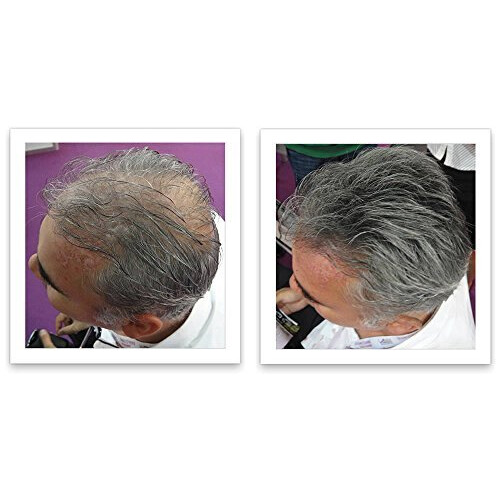 Corrector para la ca  da del cabello Caboki (suministro de 90 d  as) Marr  n oscuro 1