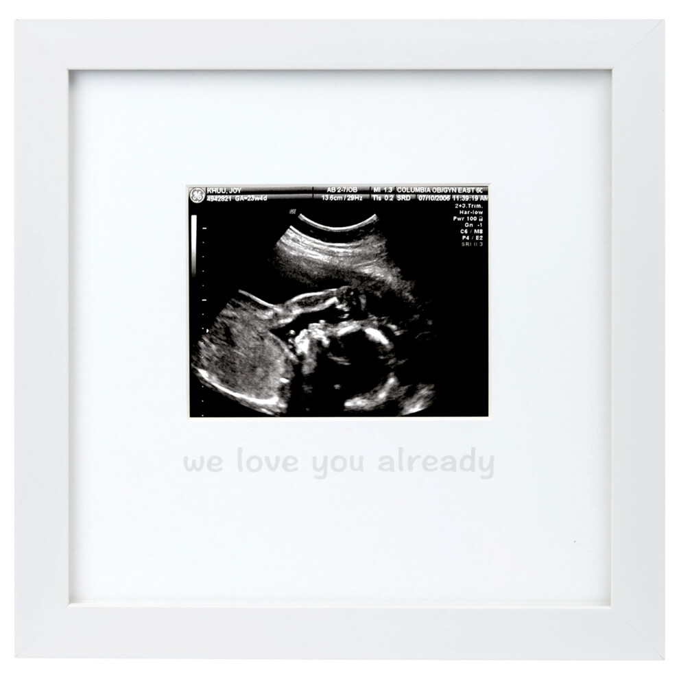 We Love You Already Sonogram Sentiment Frame Baby Announcement Gender Neutral Ultrasound Keepsake Ideal Pregnancy Gift Baby Shower And Tiny Ideas