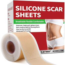 Silicone Littekensheets (1,6" x 60" Rol-1,5M), Medische Silicone Littekentape Rol, Herbruikbare Littekenstrip, Professionele Littekensheets voor