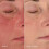 Dermalogica Dermalogica Sta?e??p???t??? ????a ?pa?????s?? ???dat??? ????a ???s?p?? ??a ??a?s??t? ????a ?e Cica - ??d??a???e?, ?atap?a??e? ?a? ?pa??????e? t? ?e??a 4