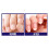 BARIELLE Biotin Pro-Growth Base Coat e Top Coat Collection Set da 2 pezzi 5