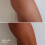 #NAME? 3