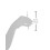 Denco Skin Care Tool Extractor 5
