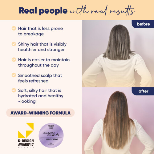 Moerie Shampoo e Conditioner con Maschera e Spray Mega Pack - La Cura per la Crescita 2