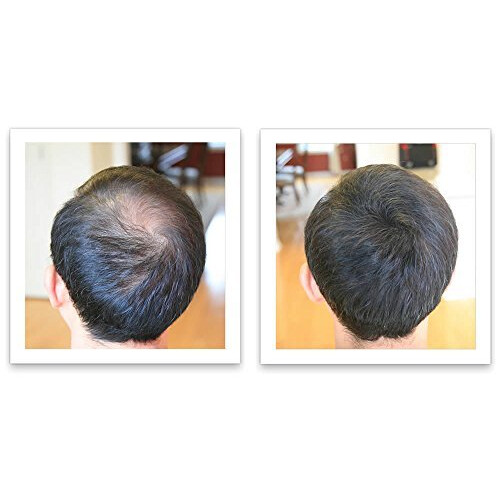 Corrector para la ca  da del cabello Caboki (suministro de 90 d  as) Marr  n oscuro 2