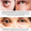 Creme para os olhos com nicotinamida remove olheiras e bolsas sob os olhos 6