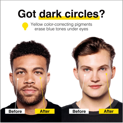 Lumin Instant Dark Circle Corrector for Men (Not A Concealer)  Reduce 1