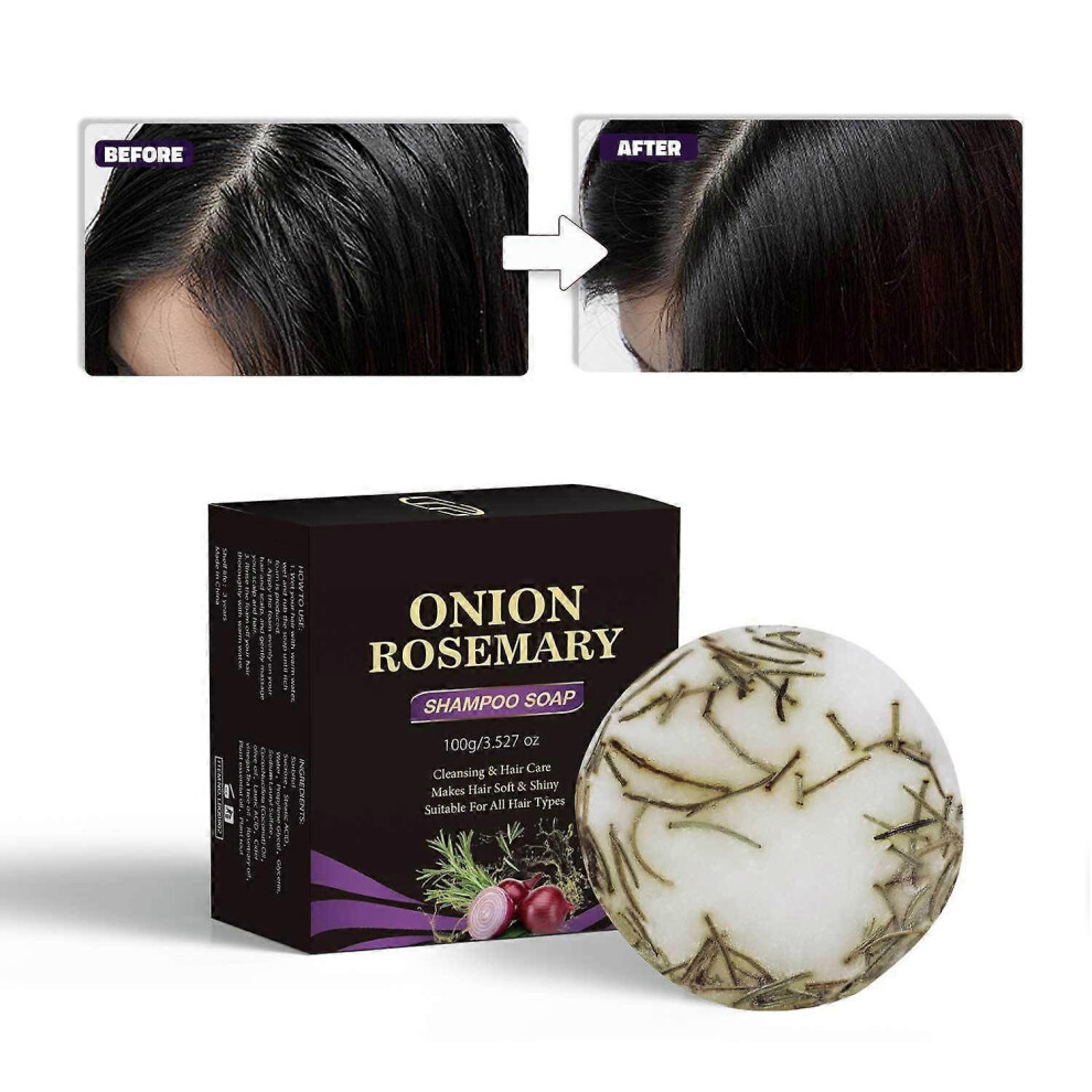 (3PCS) Online Rosemary Hair Shampoo Bar,Deep Cleansing for Scalp Hair Loss Shampoo Soap, Organic Shampoo Oil Control,Solid Shampoo Bar for Hair Growth, Refre
