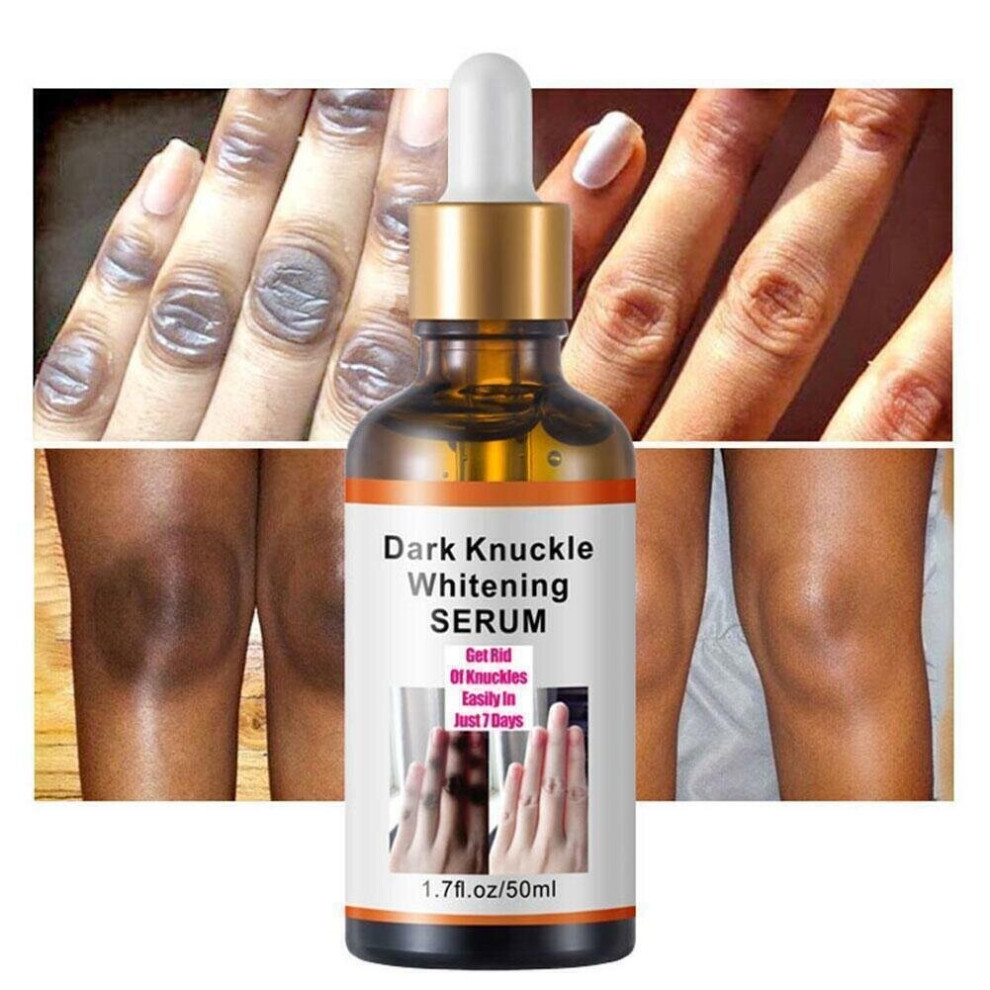 Acanthosis Nigricans Therapy Oil, Dark Spot Corrector Oil