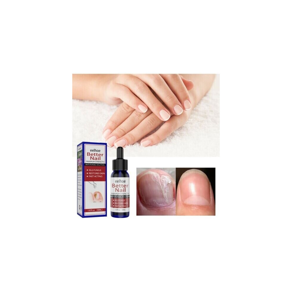 Nail Repair, Fingernail And Toenail Repair, Maximum Strength Nail Solution