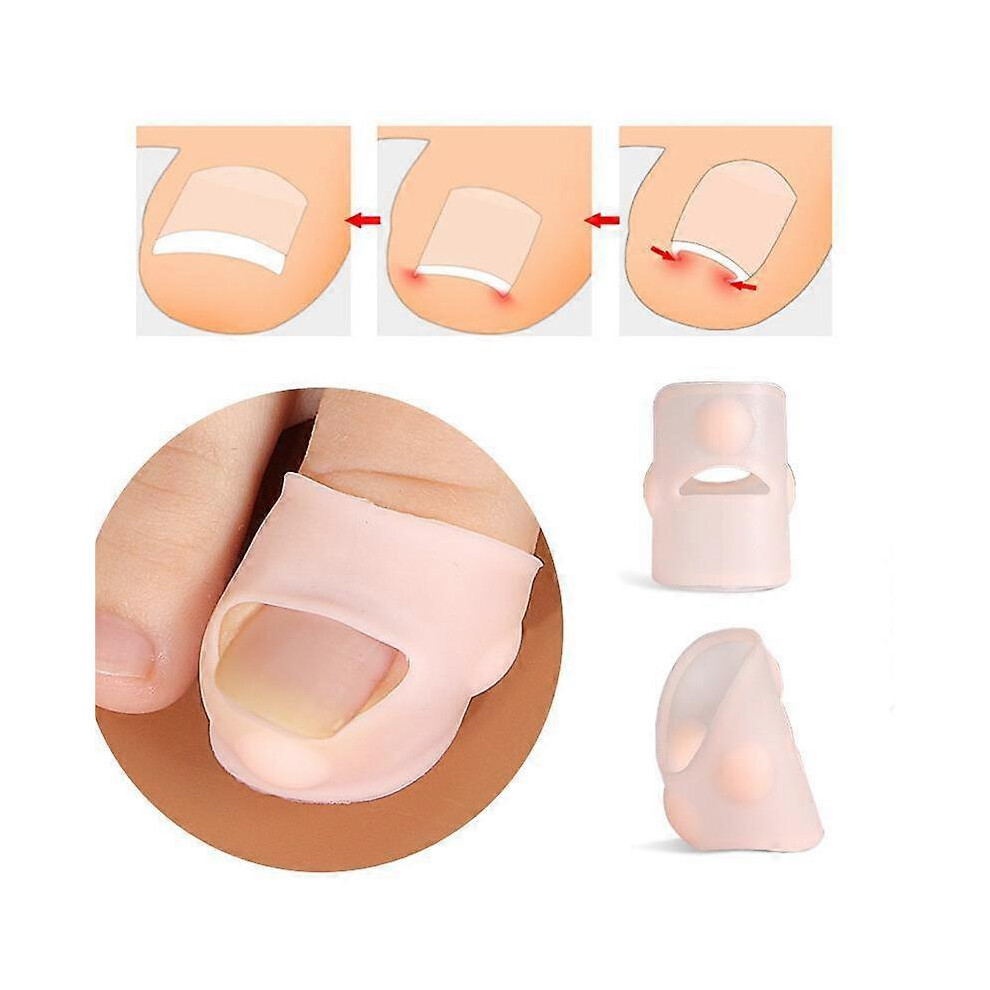 5Pcs Silicone Ingrown Toenail Treatment,Ingrown Toenail Correcting Tool Pain Relief Paronychia Treatment Corrector