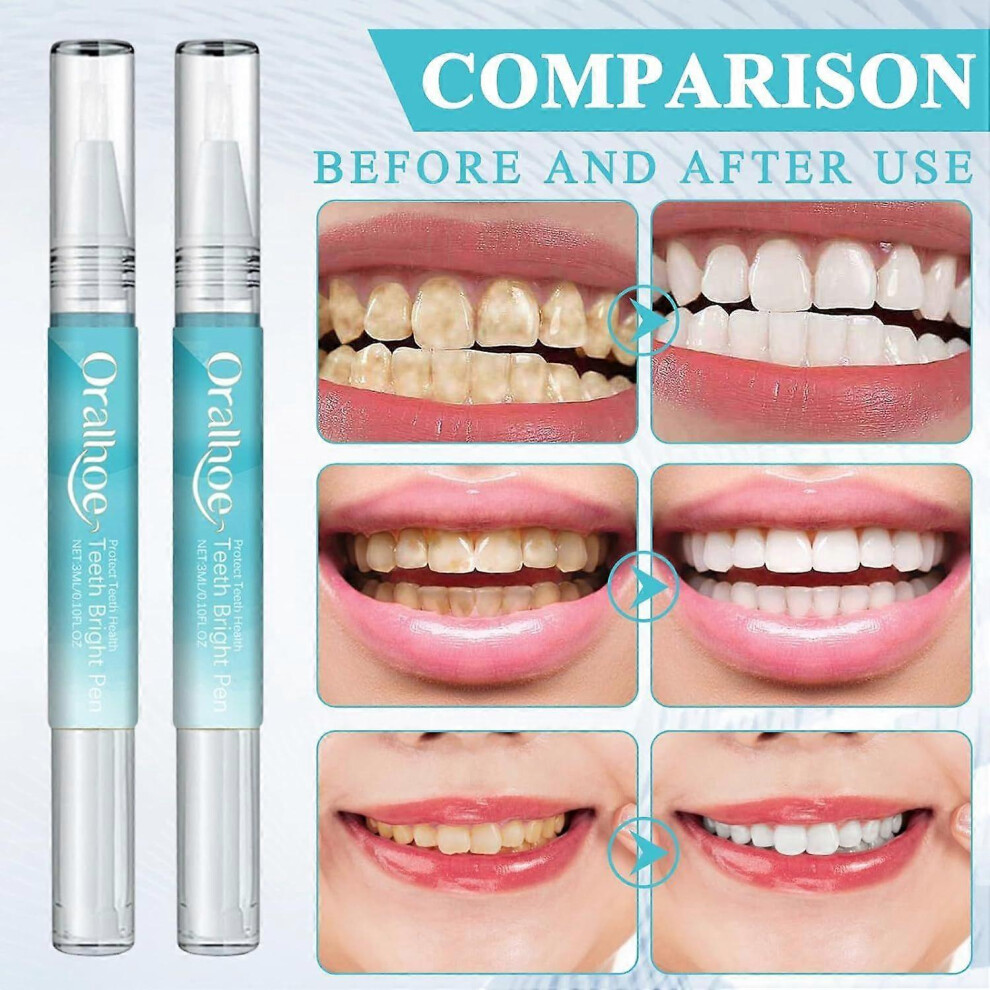 (4pcs) Teeth Whitening Pen x 2, Teeth Whitening Pen Removes Stains Quickly Brightens Teeth Whitening and Painless Teeth Whitening Teeth Whitening Blea