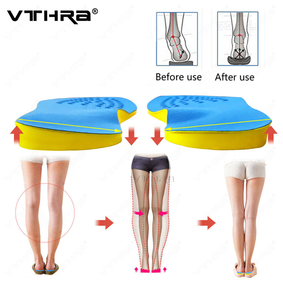 O/X Leg Orthopedic Insoles Correction Shoes Inserts For Foot Alignment Knock Knee Pain Bow Valgus Varus Feet Care Cushions