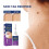 Skin Tag Remover Haut Tag Remover Serum von 5