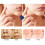 Skin Tag Remover Haut Tag Remover Serum von 2