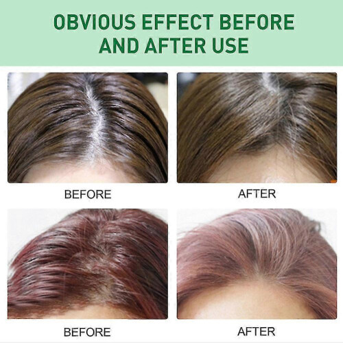 3Pcs Dry Shampoo Powder Hair Spray 2