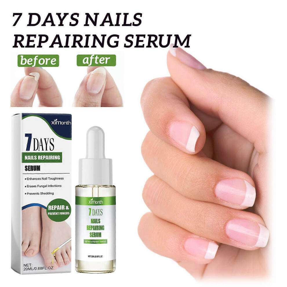 (2 Pcs) 7 Days Nail Growth and Strengthening Serum Nail,Nail Serum Repair Essence, Nail Cuticle Oil Strengthener  for Growth and Repair for Damaged Na-image-OPC-PGJC9RY-NEW