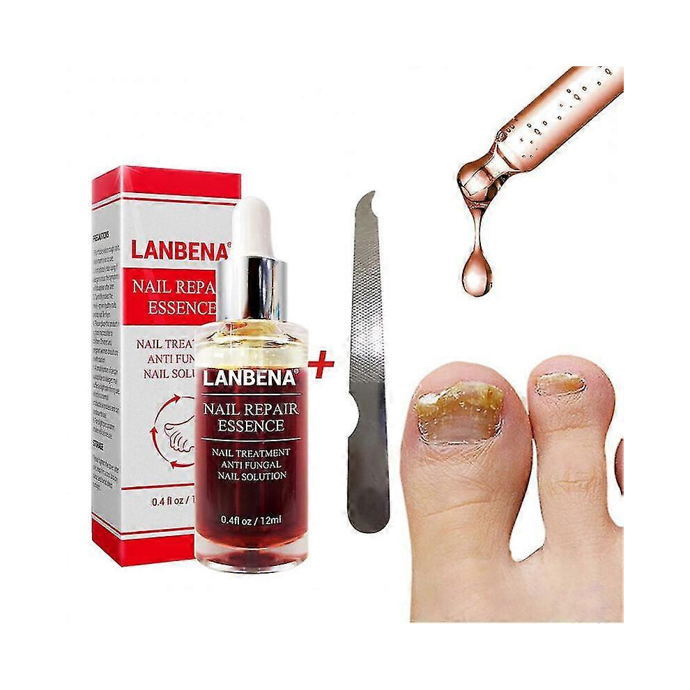 (12ml) Lanbena Nail Repair Liquid Nail Treatment With File Effective Anti Fungal Fingernails
