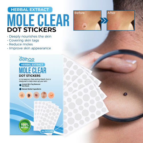 EELHOE Mole Removal On Skin Mole Mole Mole Mole Mole Mole Mole Mole Mole Mole Callus Set Clean Repair 1