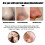EELHOE Black Pig Nose Patch, Bamboo Charcoal Remove Blackhead Acne Tear Nose Mask Patch 3