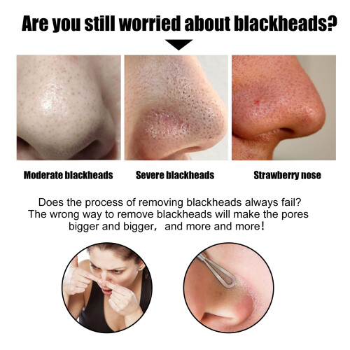 EELHOE Black Pig Nose Patch, Bamboo Charcoal Remove Blackhead Acne Tear Nose Mask Patch 2