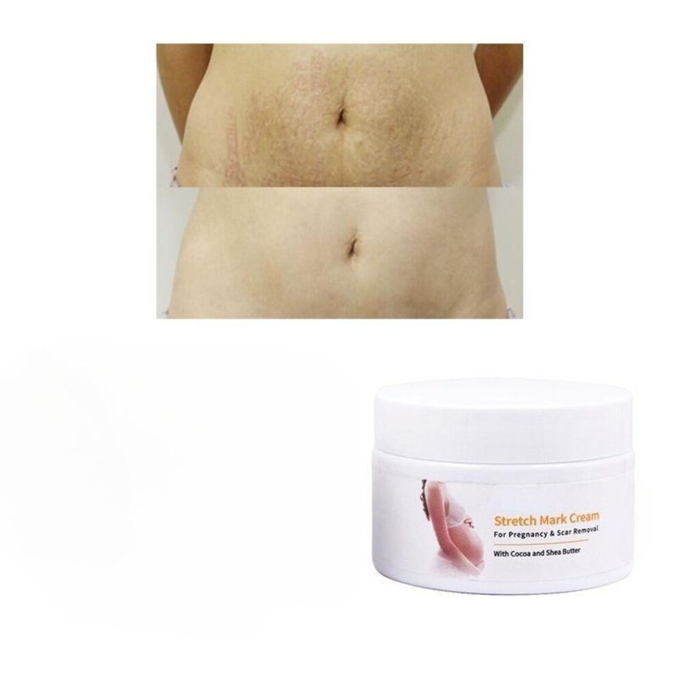 (30g) Private Label  Natural Vegan Effective  Removal Mango Repair Body Skin Care Smooth Repair  Cream