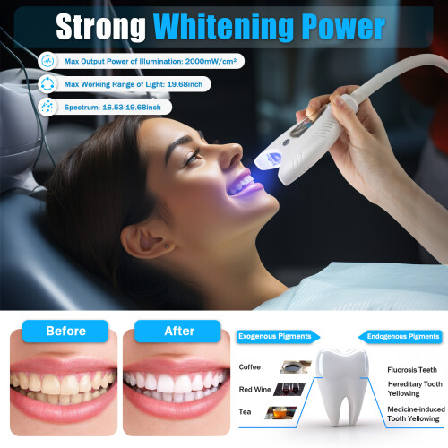 Cold Light Teeth Whitening Machine Kit 1