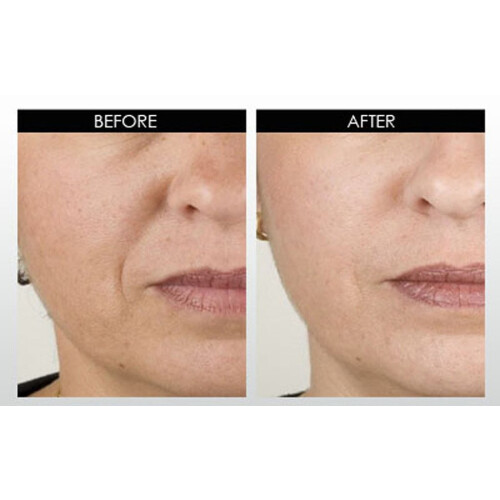 DNA Code NeuroPeptide Serum: Argireline, Matrixyl 3000, Syn-Ake, SNAP-8, Kupferpeptide 2