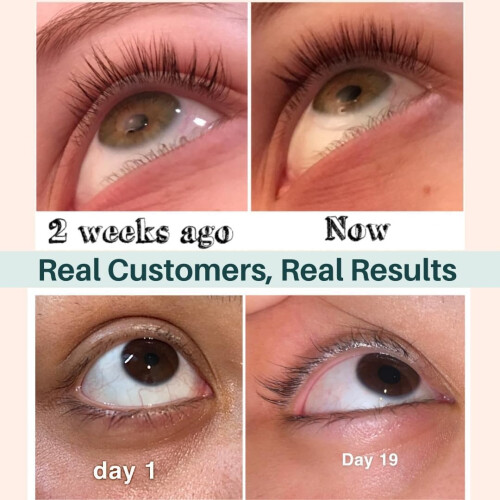 USDA Βιολογικό Έλαιο Ρυζιού - Φυσικό Σερμ για Ανάπτυξη Βλεφαρίδων 2