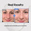 APOTHE Peptide 11 Botulinum Essence Toner 250ml (8,45 fl.oz.) 2