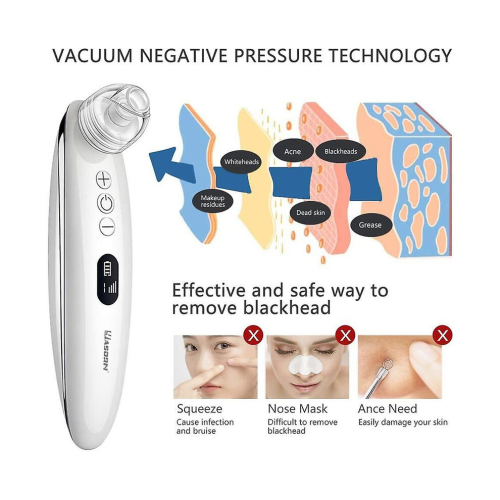 Chronus Blackhead Remover: 1080P Camera, Rechargeable Pore Cleaner 2