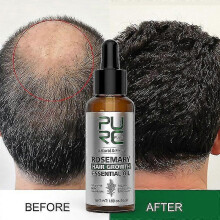 Rosemary Oil 50ml for Hair Growth - Anti-Hair Loss, Rapid Regrowth, Scalp Treatment for Men and Women