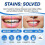 Magic Toothpaste Whitening Booster Powder,Magic Teeth Whitening Powder 5