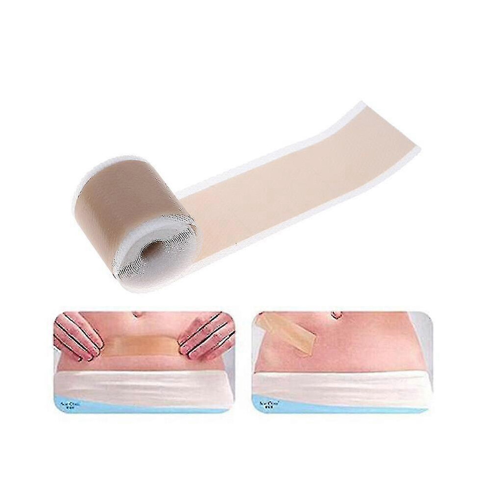 4x150cm High Efficiency Surgical Scar Removal Silicone Sheet Therapy Patch for Acne Trauma Burn Scars