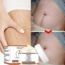 Stretch Marks Removal Cream Fat Growth Streaks Maternity Scars Acne Repair Increase Skin Elasticity Anti-wrinkle Firm Body Care