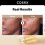 Cosrx Das Alpha-Arbutin 2 Discolor Pflegeserum 2