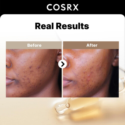 Cosrx CosRx, Η Αλφα-Αρμπούτιν 2 Δισκόλευρη Περίθαλψη Σερουμ, 1,69 fl oz (50 ml) 1