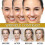 3x Advanced Bee-venom Serum Anti-aging Moisturizer for Face And Neck-- 3